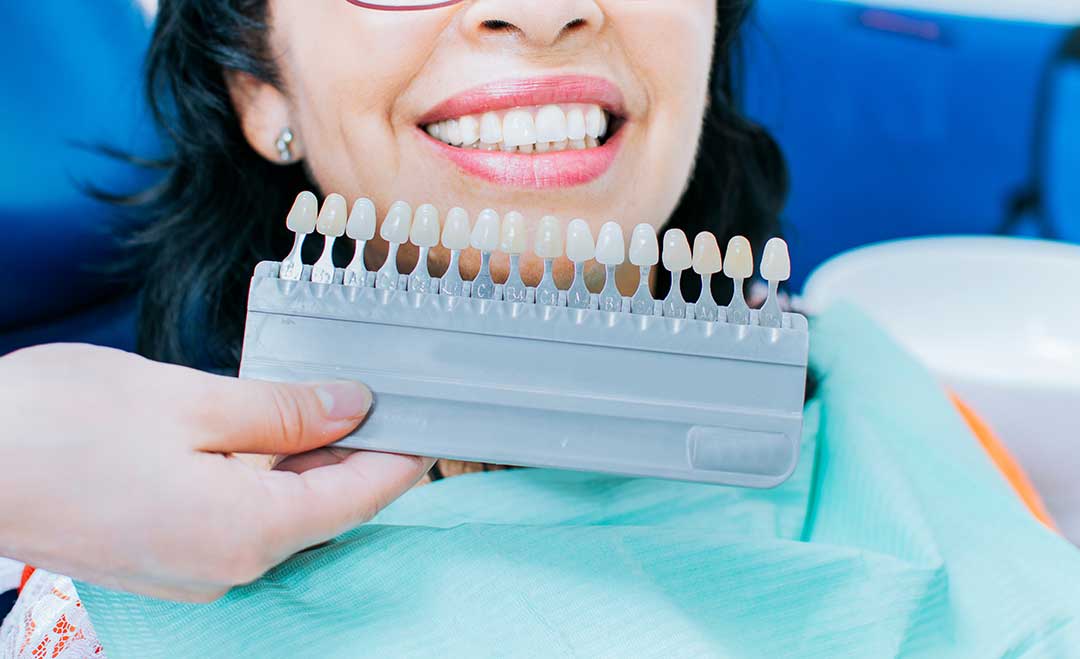 Cosmetic Dentistry photo from Adobe Stock