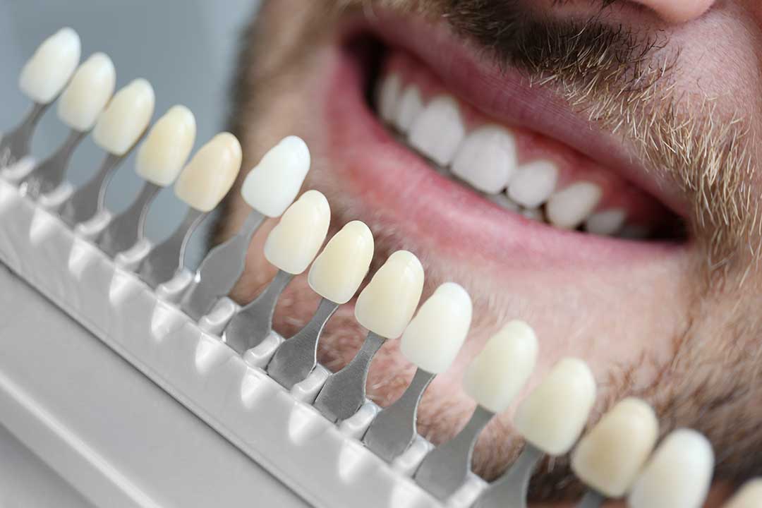 Cosmetic Dentistry photo from Adobe Stock