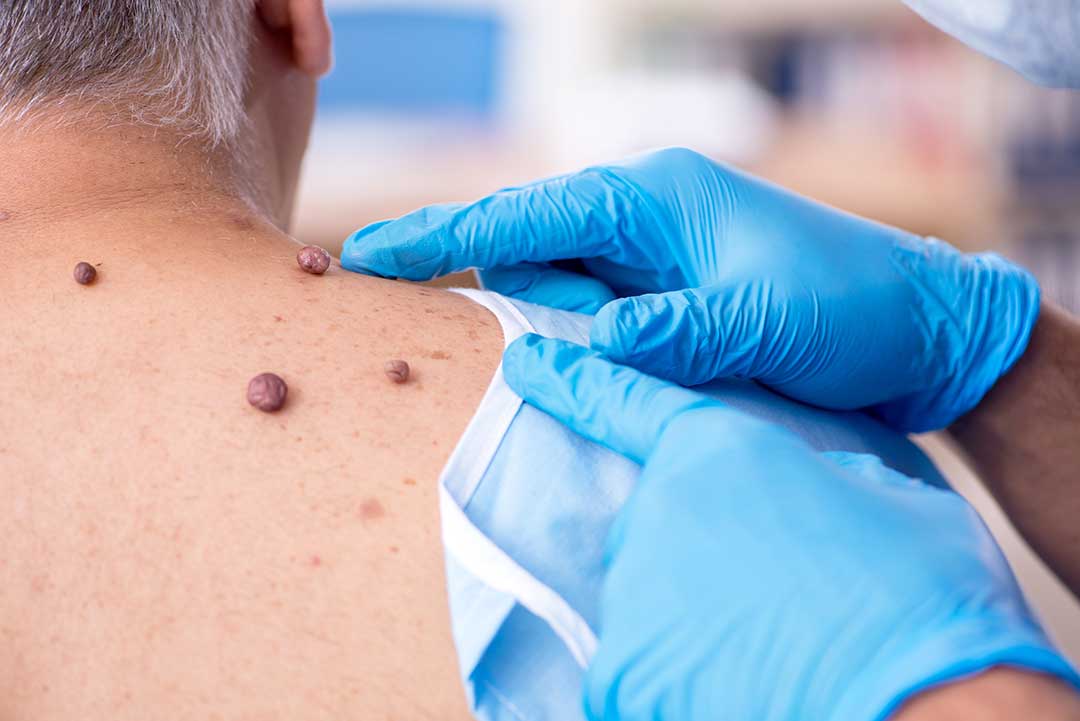 Dermatology photo from Adobe Stock