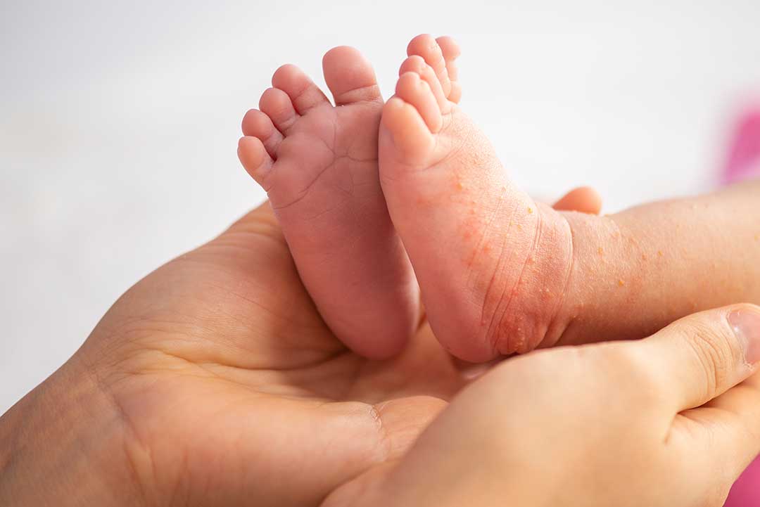 Dermatology photo from Adobe Stock