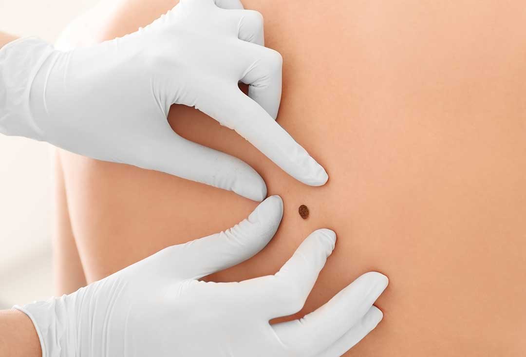 Dermatology photo from Adobe Stock