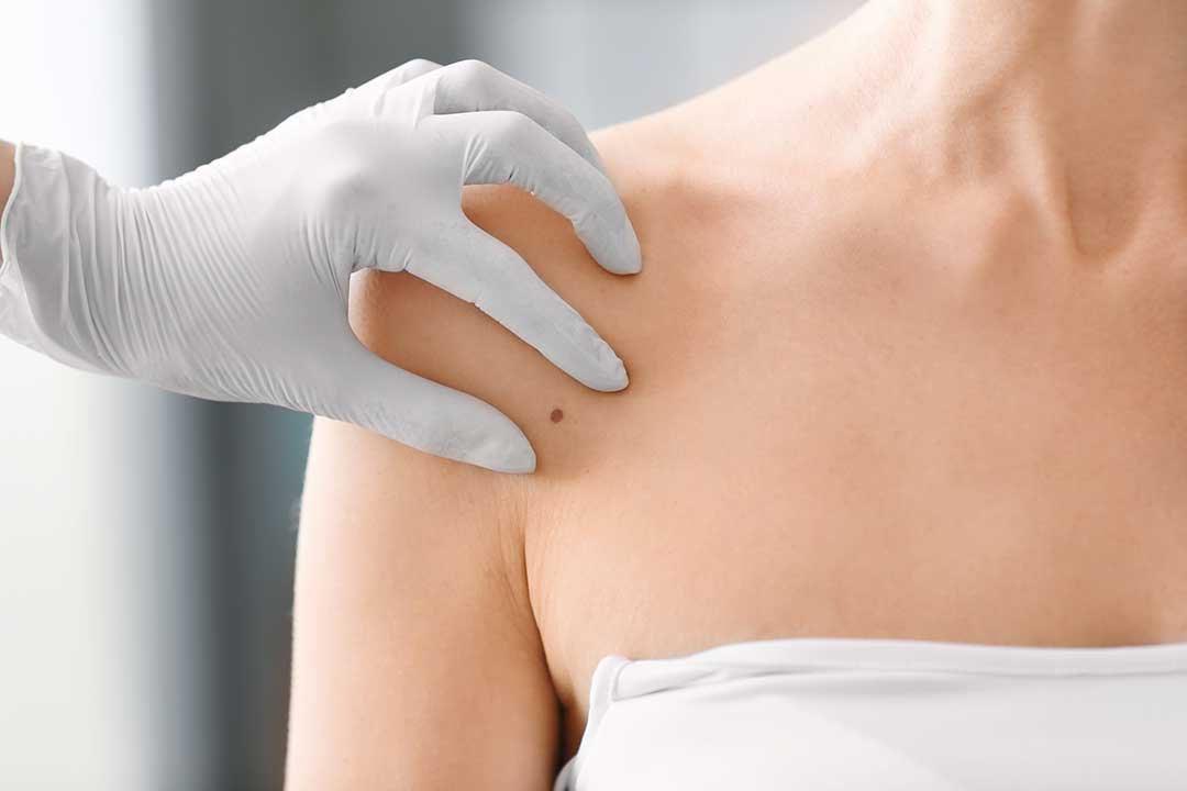 Dermatology photo from Adobe Stock