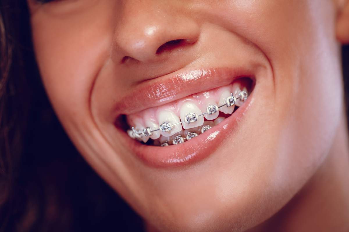 Orthodontics photo from Adobe Stock