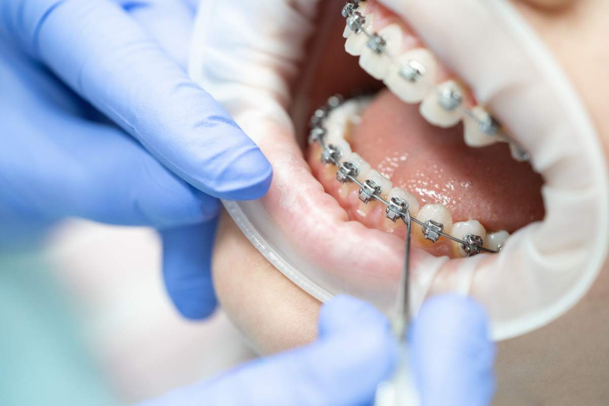 Orthodontics photo from Adobe Stock