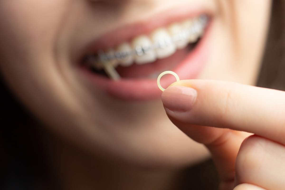 Orthodontics photo from Adobe Stock