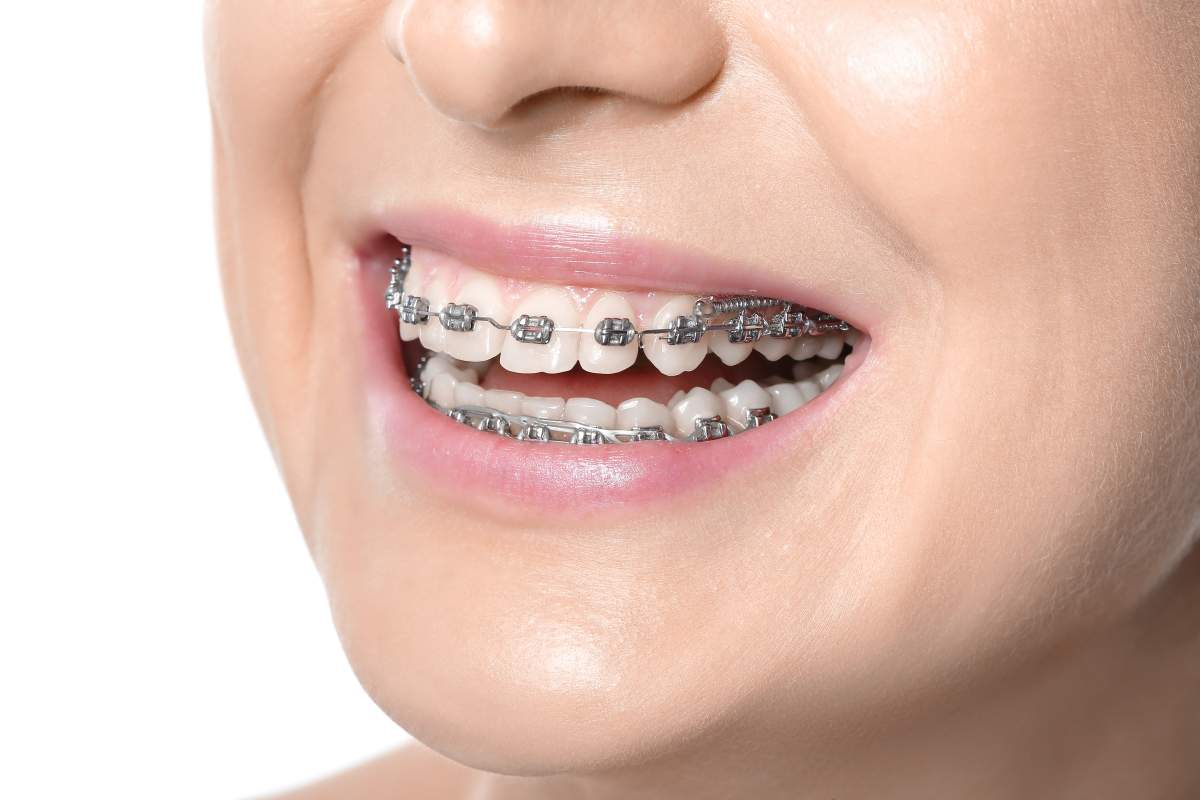 Orthodontics photo from Adobe Stock