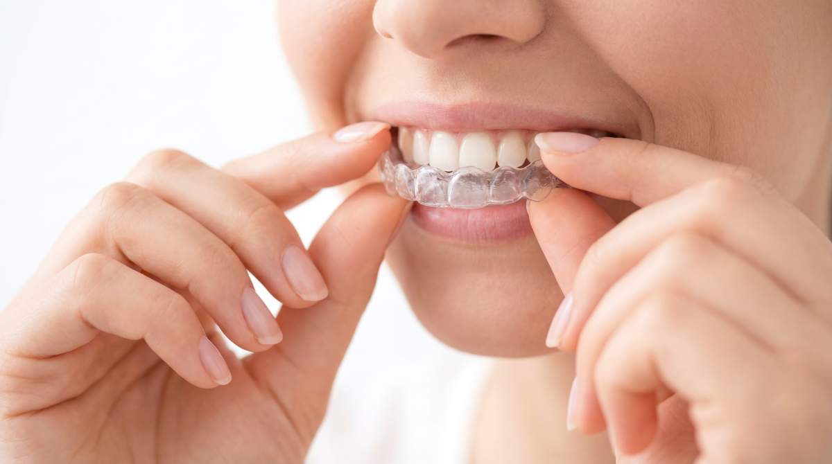 Orthodontics photo from Adobe Stock