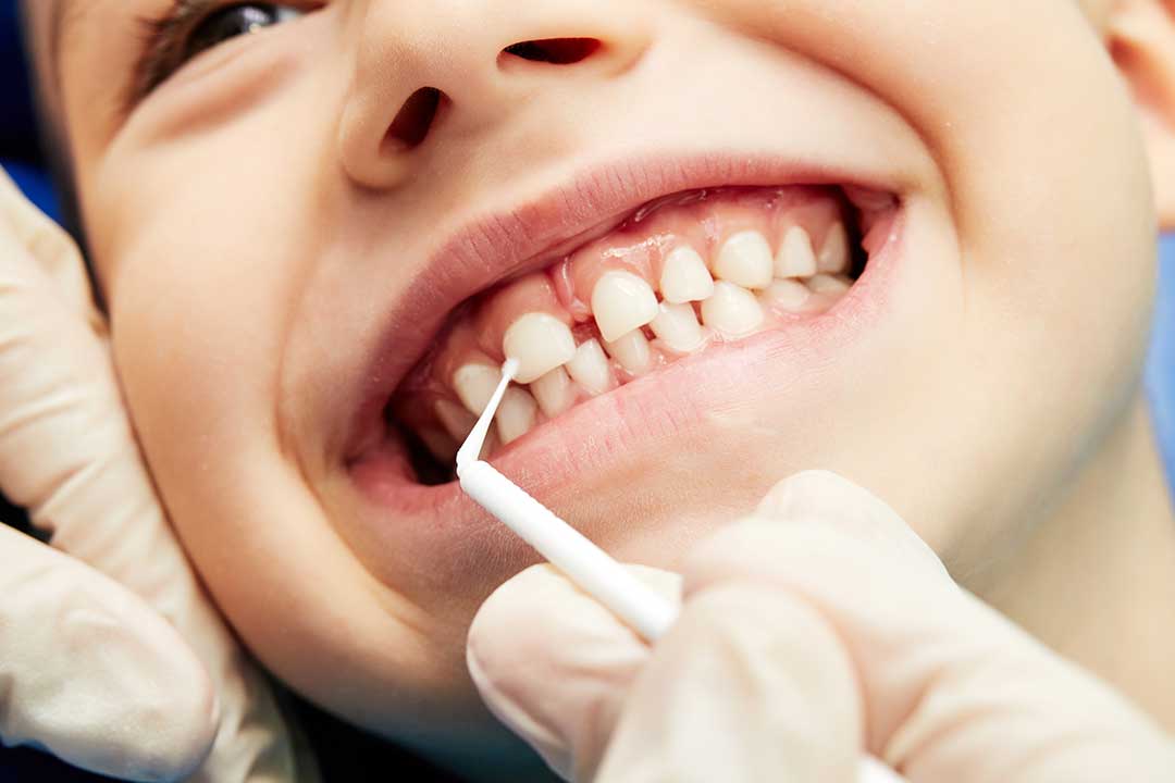 Pediatric Dentistry photo from Adobe Stock